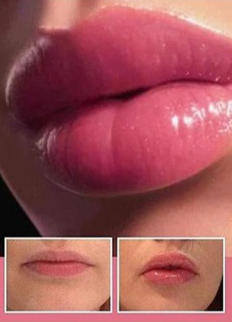 Lip Maximizer karite™️ - Estética y Belleza