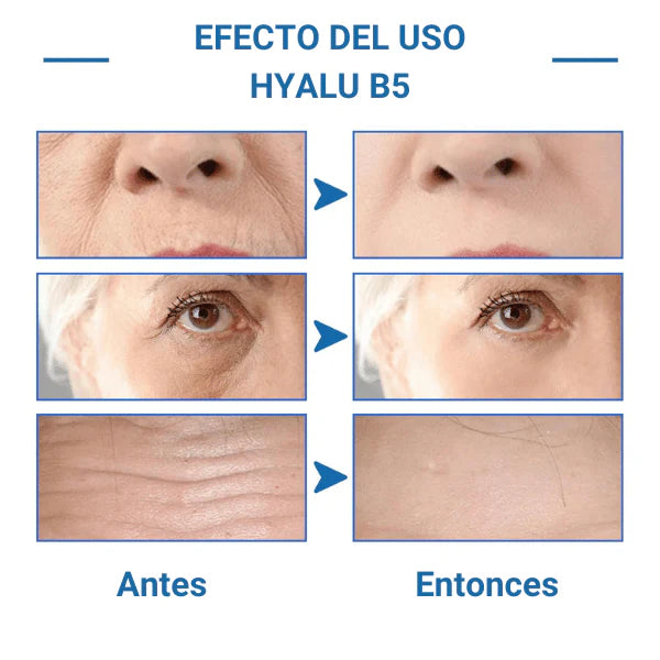 Ácido Hialurónico B5™ - Hidratante e Rejuvenescedor